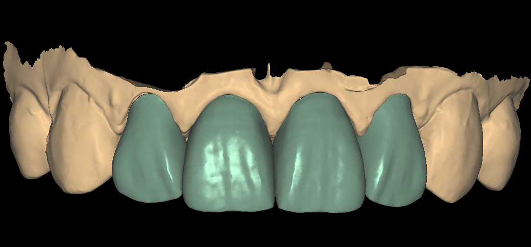 DSD Smile Design 2-1