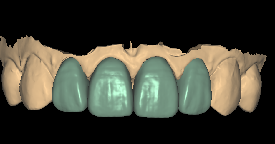 DSD Smile Design 3-1