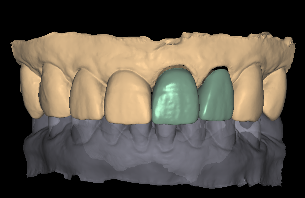 DSD Smile Design