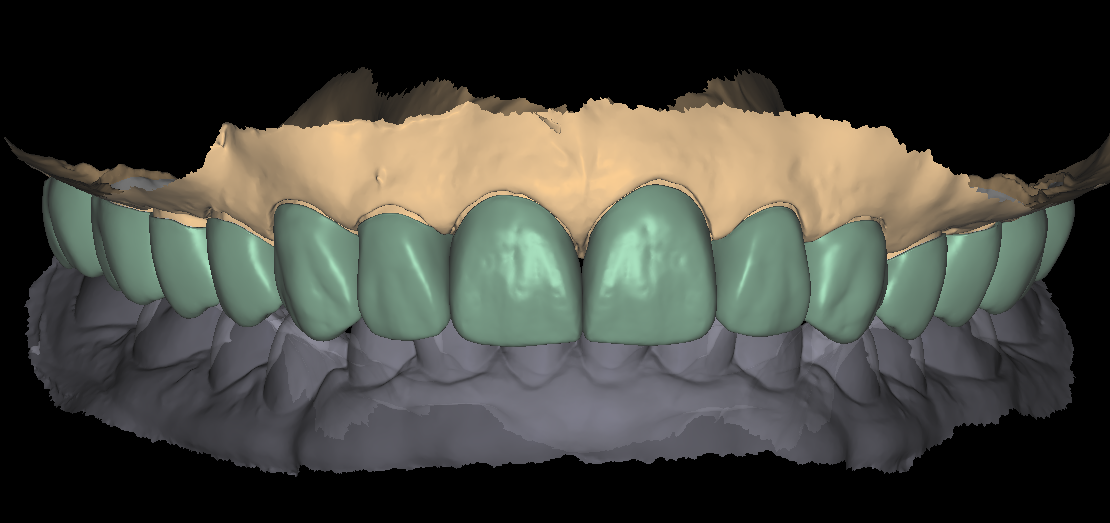 DSD Smile Design 5-1