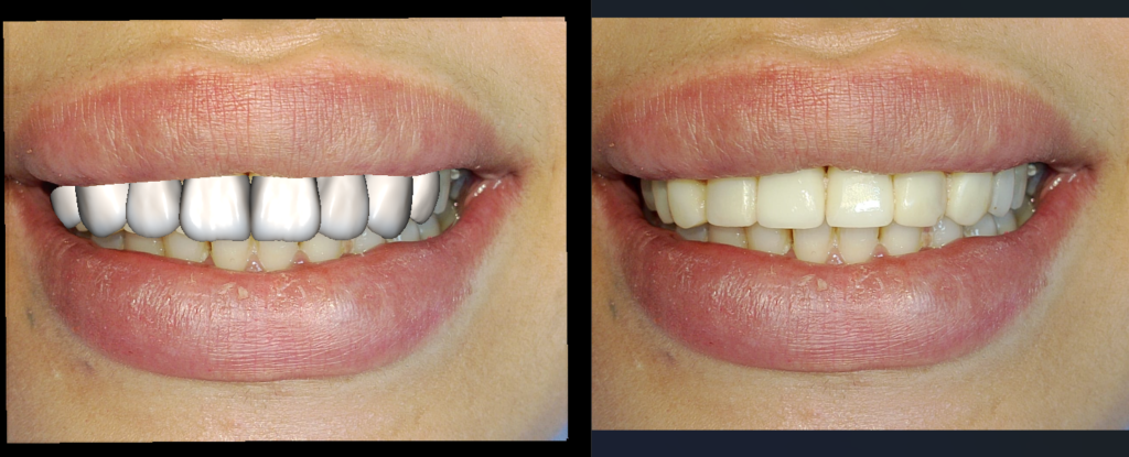 DSD Smile Design 6-7