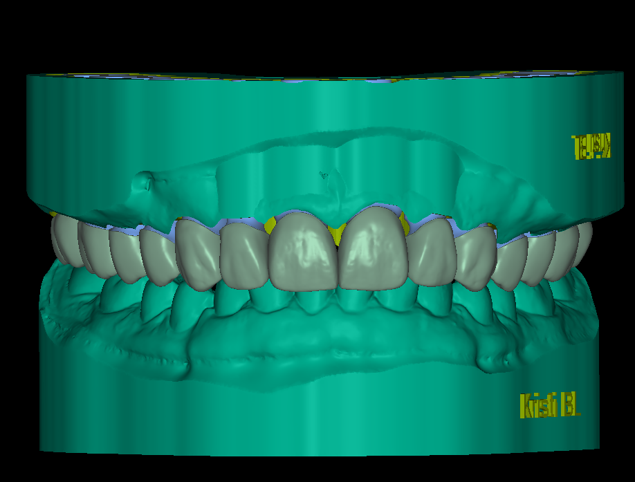 E-Model - Image 3