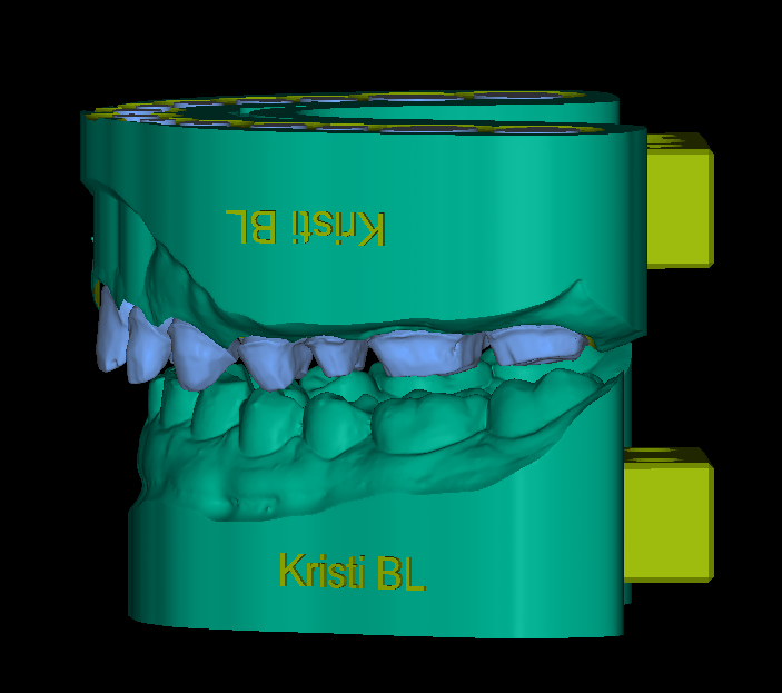E-Model - Image 2