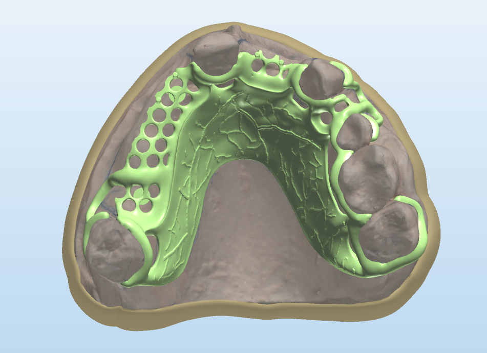Green CAD render of a partial denture framework seated on a mandibular model, ready for production