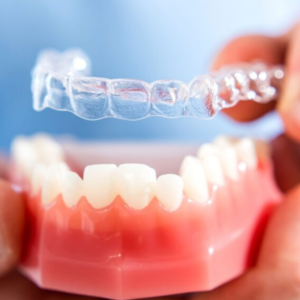 Invisible Align Treatment Plan -2