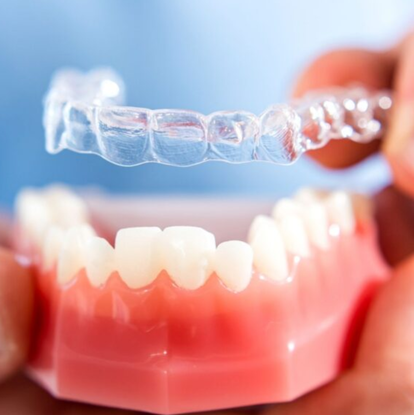 Invisible Align Treatment Plan -2