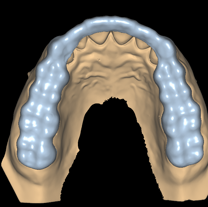 Splint Design